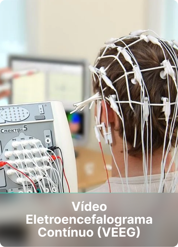 eletroencefalograma